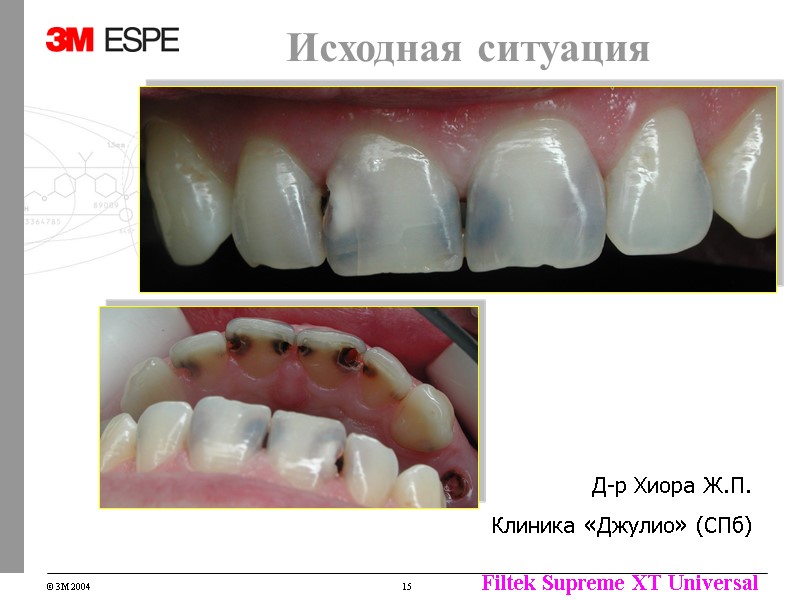 Исходная ситуация Д-р Хиора Ж.П. Клиника «Джулио» (СПб) Исходная ситуация Д-р Хиора Ж.П. Клиника «Джулио» (СПб)
